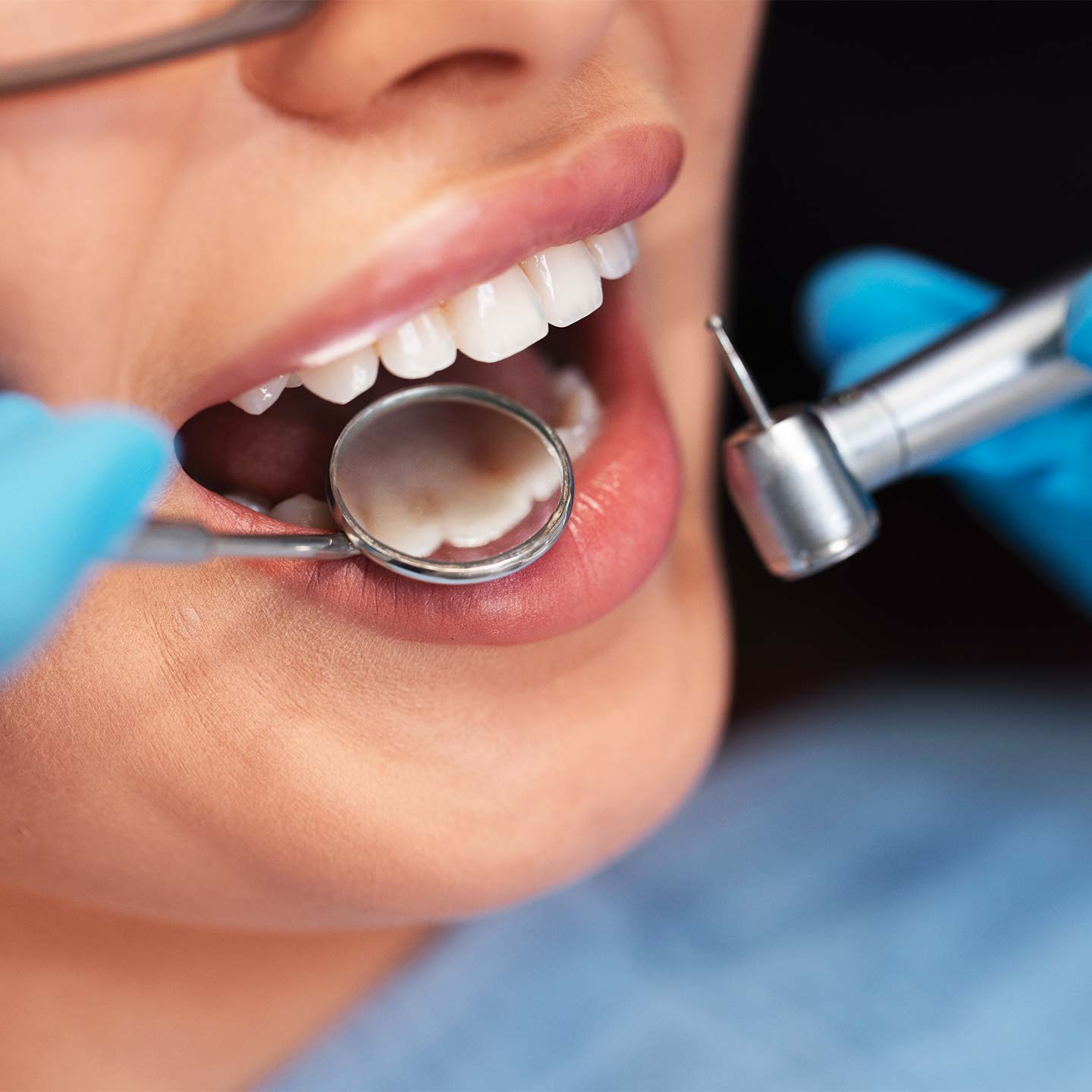 Odontoiatria conservativa endodonzia. Dottor Andrea Albani dentista a Rimini