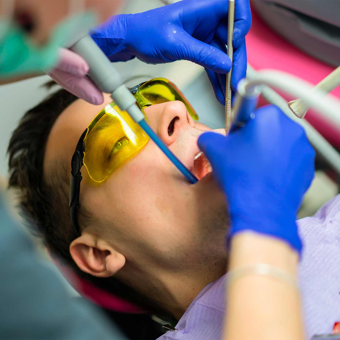 Implantologia Chirurgia orale, Dottor Andrea Albani dentista a Rimini