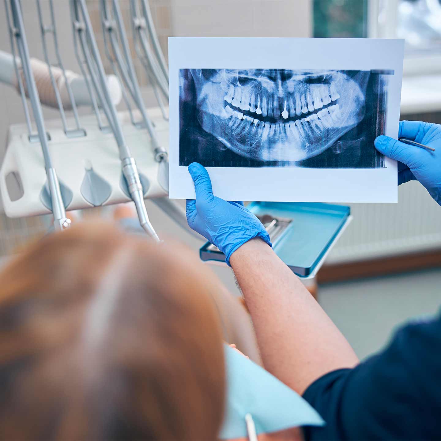 Radiologia e Workflow Digitale Dottor Andrea Albani dentista a Rimini