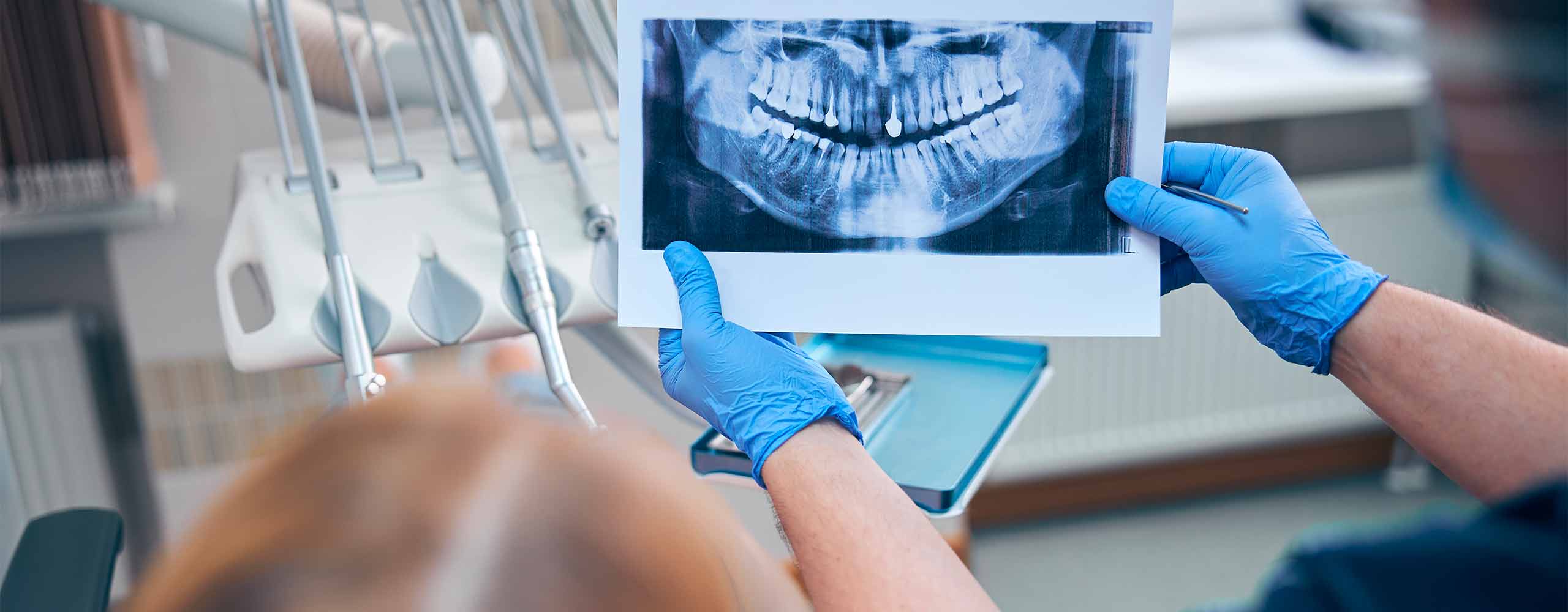 Radiologia e Workflow Digitale Dottor Andrea Albani dentista a Rimini
